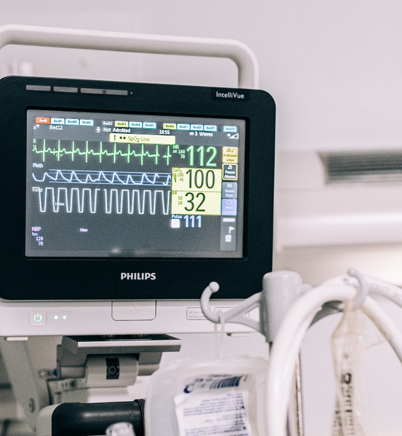 A screen by a hospital bed displaying vital signs.